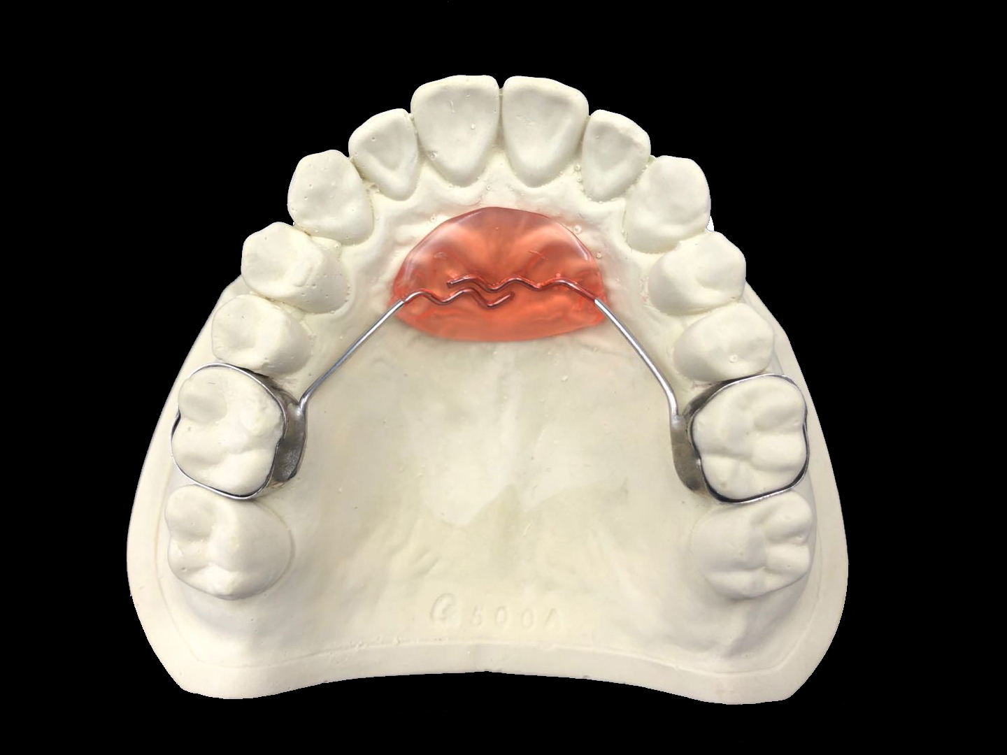 3D打印+舌刺-矫正器-云南家红齿科技术股份有限公司